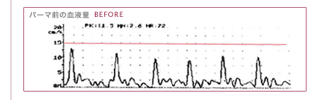 �r�[����